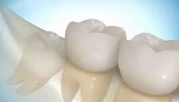 Dentes Inclusos